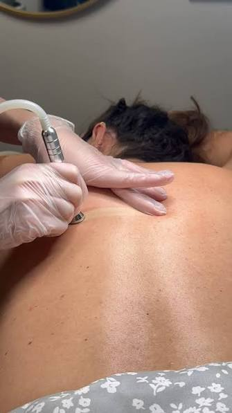 Back Microdermabrasion Facial at Majestic Aesthetics by Jaki, Columbus OH